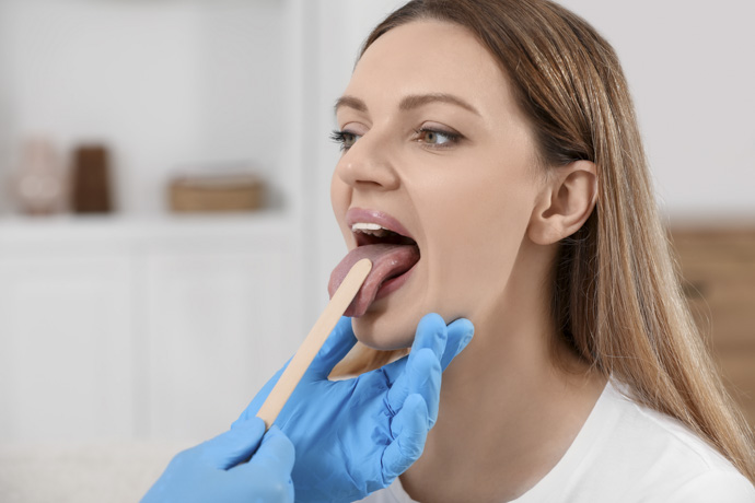 Médico diagnóstica problemas en la lengua