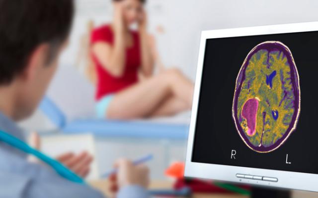 Persona recibe diagnóstico de tumor cerebral