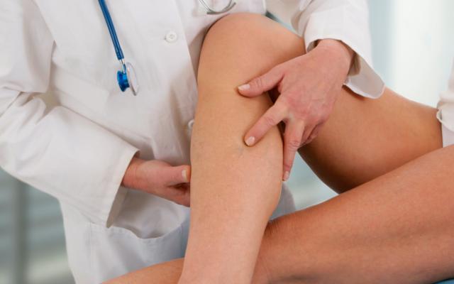 Médico revisa problemas de circulación en las piernas