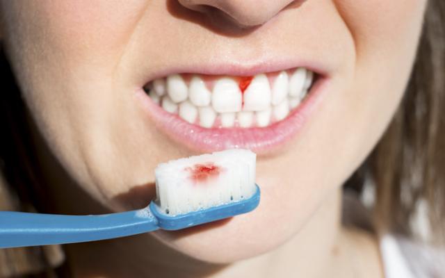 Persona con sangre en las encías