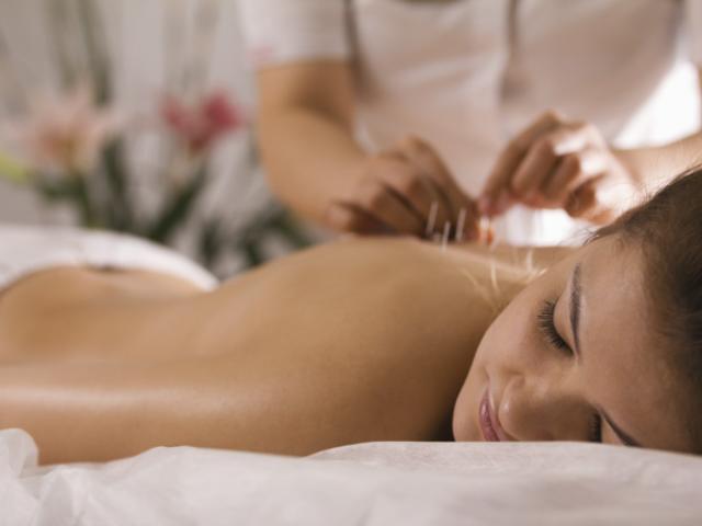 Mujer en sesión de acupuntura para dejar de fumar